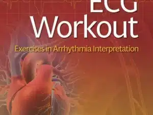 ECG Workout Exercises in Arrhythmia Interpretation